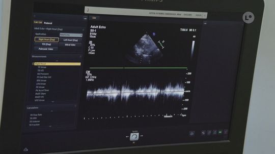 Badania USG Doppler dla mieszkańców 30+