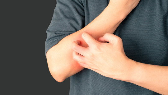 Kosmetyki na AZS – dla Ciebie!