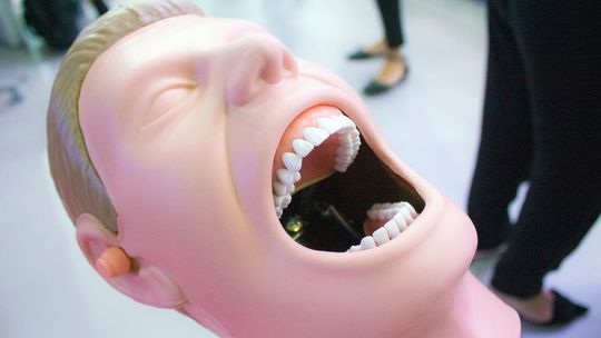 Orły Stomatologii: Jak wygląda wybielanie zębów u stomatologa?