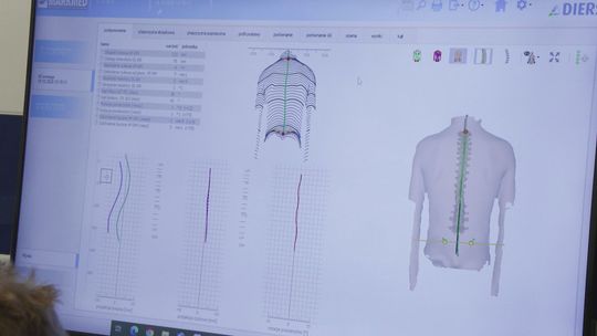 Szybkie, bezbolesne badania kręgosłupa na pływalni Neptun. Natychmiastowe wyniki i porady rehabilitacyjne