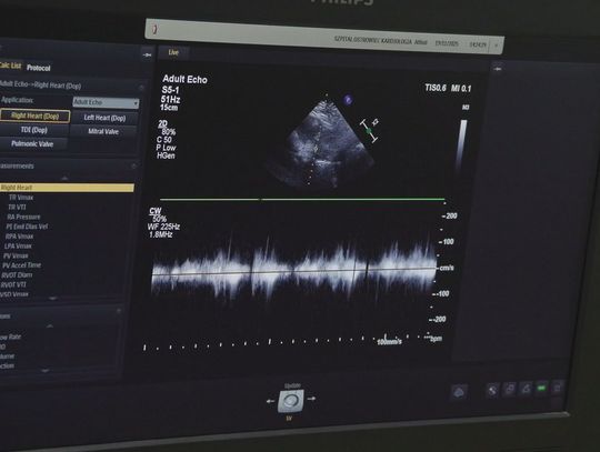 Badania USG Doppler dla mieszkańców 30+